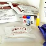 Bassano – Asiago e Valsugana ottimi risultati campagna di test all’ HIV